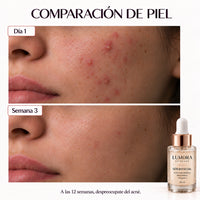 Serum premium